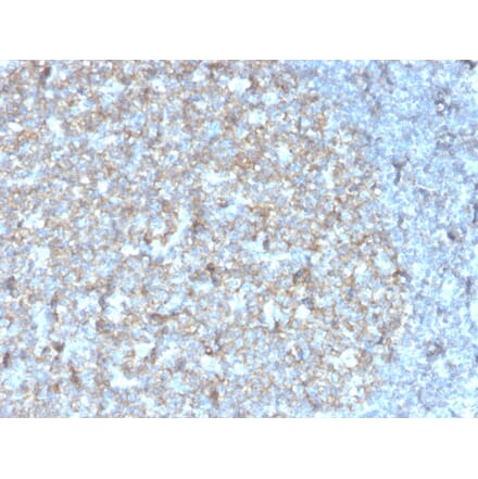 Immunohistochemistry - Anti-TAPA1 Antibody [r1.3.3.22] - BSA and Azide free (A253983) - Antibodies.com