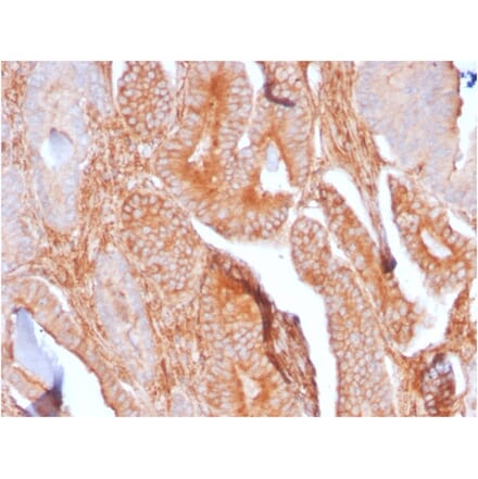 Immunohistochemistry - Anti-TAPA1 Antibody [C81/2885R] - BSA and Azide free (A253983) - Antibodies.com