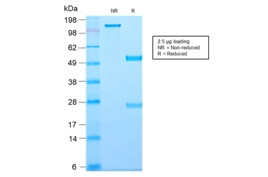 SDS-PAGE - Anti-TAPA1 Antibody [C81/2885R] - BSA and Azide free (A253984) - Antibodies.com