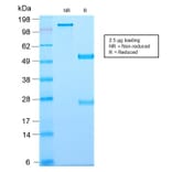 SDS-PAGE - Anti-TAPA1 Antibody [C81/2885R] - BSA and Azide free (A253984) - Antibodies.com