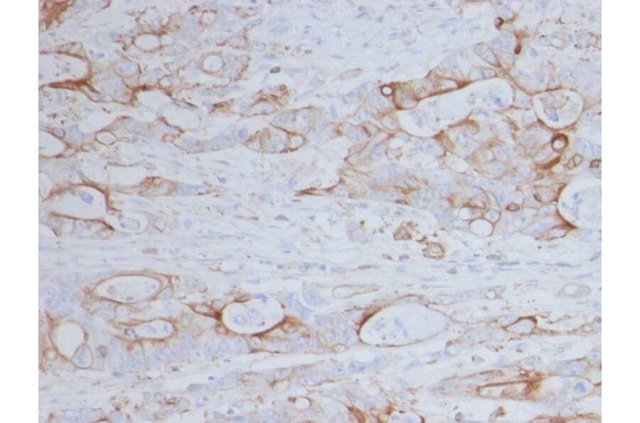 Immunohistochemistry - Anti-CD151 Antibody [11G5a] - BSA and Azide free (A253984) - Antibodies.com