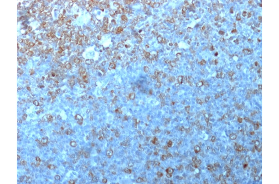 Immunohistochemistry - Anti-CDK1 Antibody [POH-1] - BSA and Azide free (A253985) - Antibodies.com