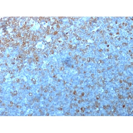 Immunohistochemistry - Anti-CDK1 Antibody [POH-1] - BSA and Azide free (A253985) - Antibodies.com