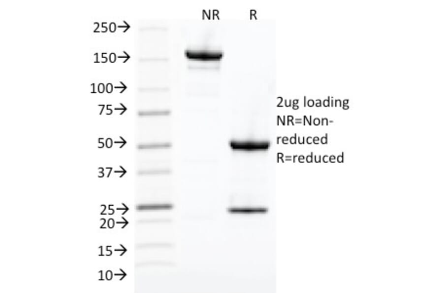 SDS-PAGE - Anti-CDK1 Antibody [POH-1] - BSA and Azide free (A253986) - Antibodies.com