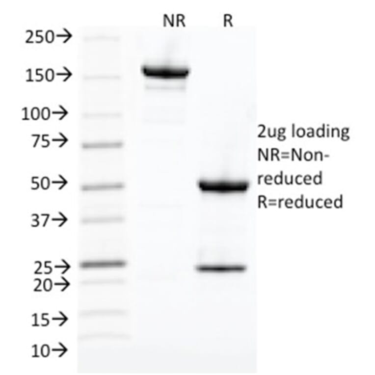 SDS-PAGE - Anti-CDK1 Antibody [CDK1/873] - BSA and Azide free (A253987) - Antibodies.com