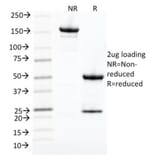 SDS-PAGE - Anti-CDK1 Antibody [CDK1/873] - BSA and Azide free (A253987) - Antibodies.com