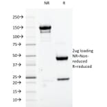 SDS-PAGE - Anti-CDK1 Antibody [A17.1.1] - BSA and Azide free (A253988) - Antibodies.com