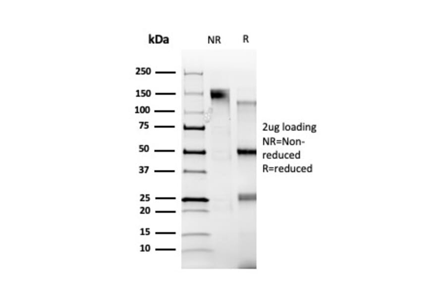 SDS-PAGE - Anti-ZBTB39 Antibody [PCRP-ZBTB39-1A11] - BSA and Azide free (A253990) - Antibodies.com