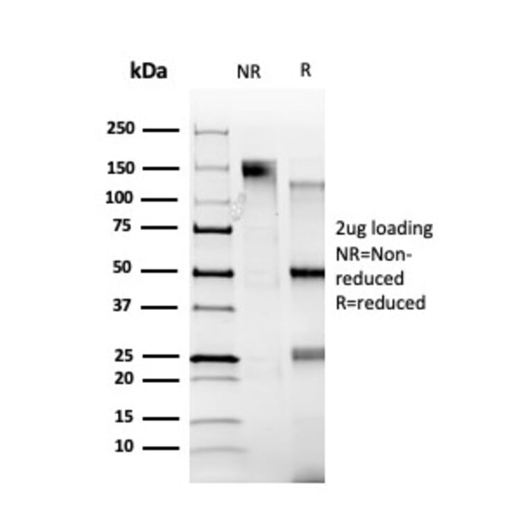 SDS-PAGE - Anti-ZBTB39 Antibody [PCRP-ZBTB39-1A11] - BSA and Azide free (A253990) - Antibodies.com