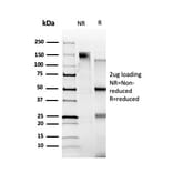 SDS-PAGE - Anti-ZBTB39 Antibody [PCRP-ZBTB39-1A11] - BSA and Azide free (A253990) - Antibodies.com