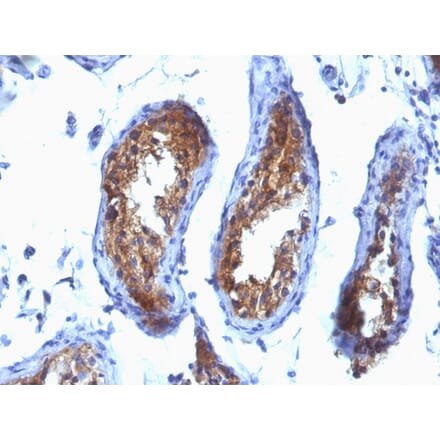 Immunohistochemistry - Anti-Major Vault Protein Antibody [SPM280] - BSA and Azide free (A253995) - Antibodies.com