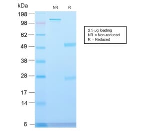 SDS-PAGE - Anti-Major Vault Protein Antibody [VP2897R] - BSA and Azide free (A253997) - Antibodies.com