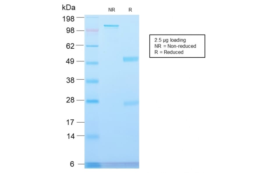 SDS-PAGE - Anti-Major Vault Protein Antibody [VP2897R] - BSA and Azide free (A253997) - Antibodies.com