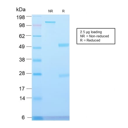 SDS-PAGE - Anti-Major Vault Protein Antibody [VP2897R] - BSA and Azide free (A253997) - Antibodies.com
