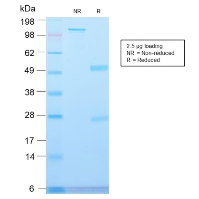SDS-PAGE - Anti-Major Vault Protein Antibody [VP2897R] - BSA and Azide free (A253997) - Antibodies.com