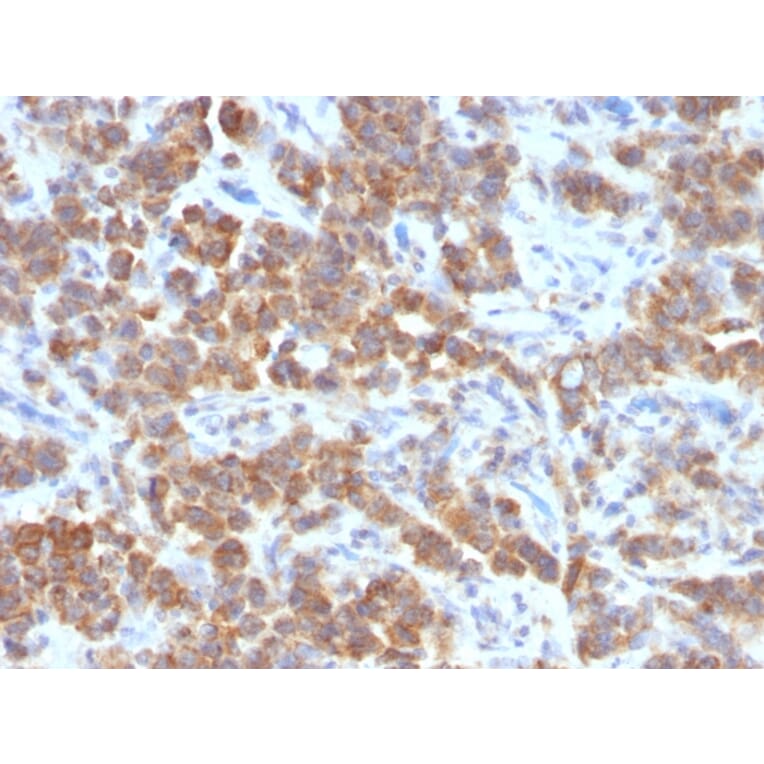Immunohistochemistry - Anti-TNFS15 Antibody [VEGI/1283] - BSA and Azide free (A253998) - Antibodies.com