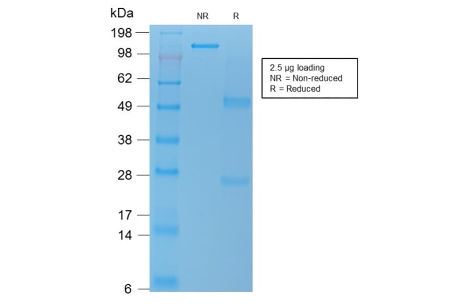 SDS-PAGE - Anti-TNFS15 Antibody [rVEGI/1283] - BSA and Azide free (A250819) - Antibodies.com