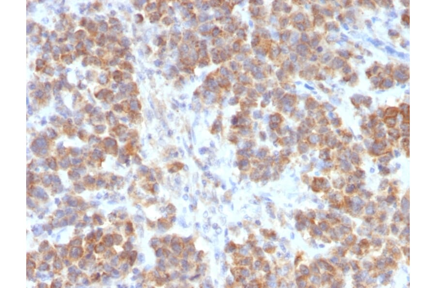 Immunohistochemistry - Anti-TNFS15 Antibody [VEGI/2052R] - BSA and Azide free (A254000) - Antibodies.com