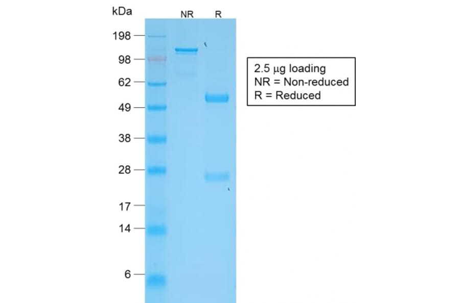SDS-PAGE - Anti-TNFS15 Antibody [VEGI/2052R] - BSA and Azide free (A254000) - Antibodies.com