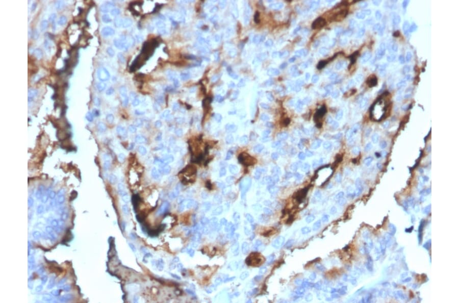 Immunohistochemistry - Anti-CDC34 Antibody [CPTC-CDC34-2] - BSA and Azide free (A254001) - Antibodies.com