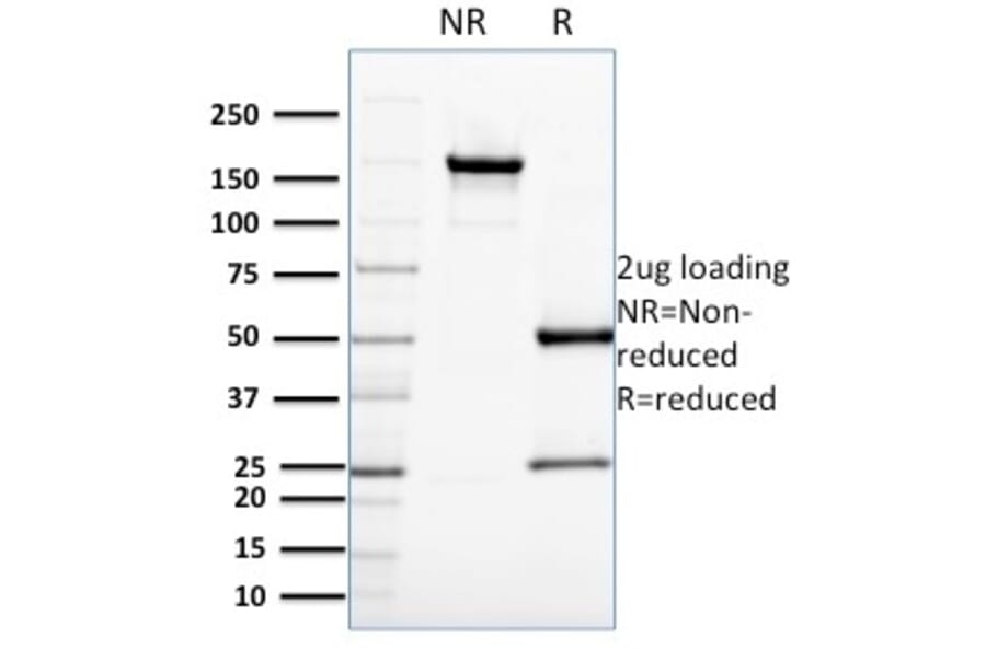 SDS-PAGE - Anti-CDC34 Antibody [CPTC-CDC34-2] - BSA and Azide free (A254001) - Antibodies.com