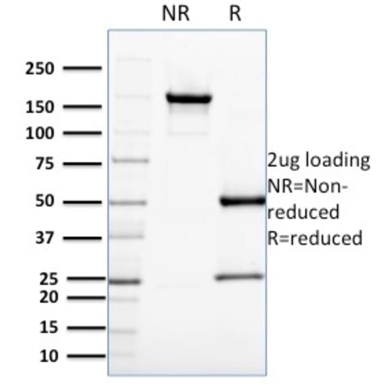 SDS-PAGE - Anti-CDC34 Antibody [CPTC-CDC34-2] - BSA and Azide free (A254001) - Antibodies.com