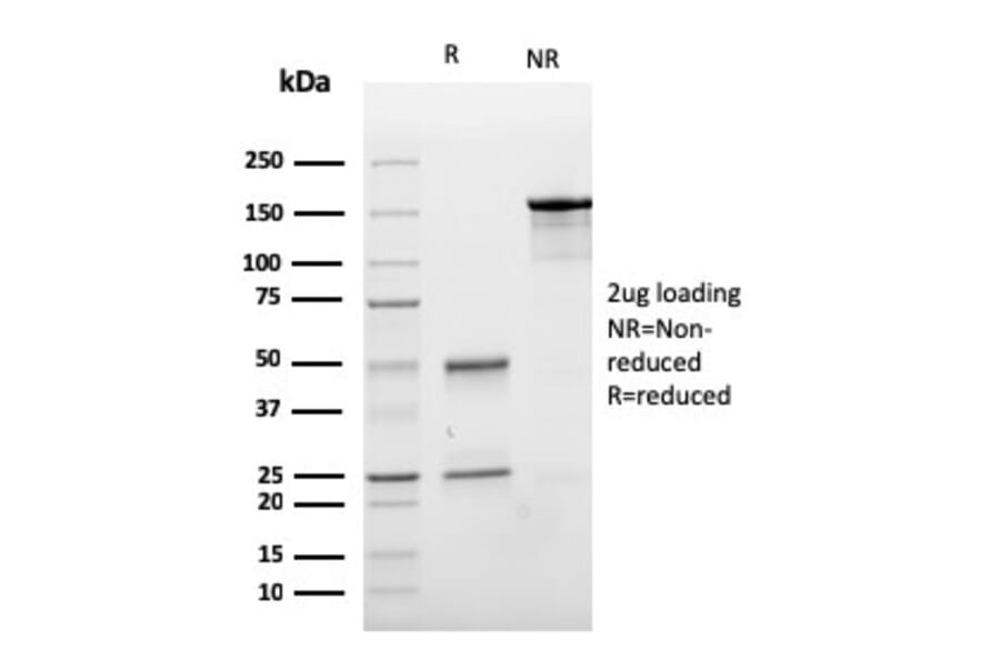 SDS-PAGE - Anti-E Cadherin Antibody [CDH1/3256] - BSA and Azide free (A254002) - Antibodies.com