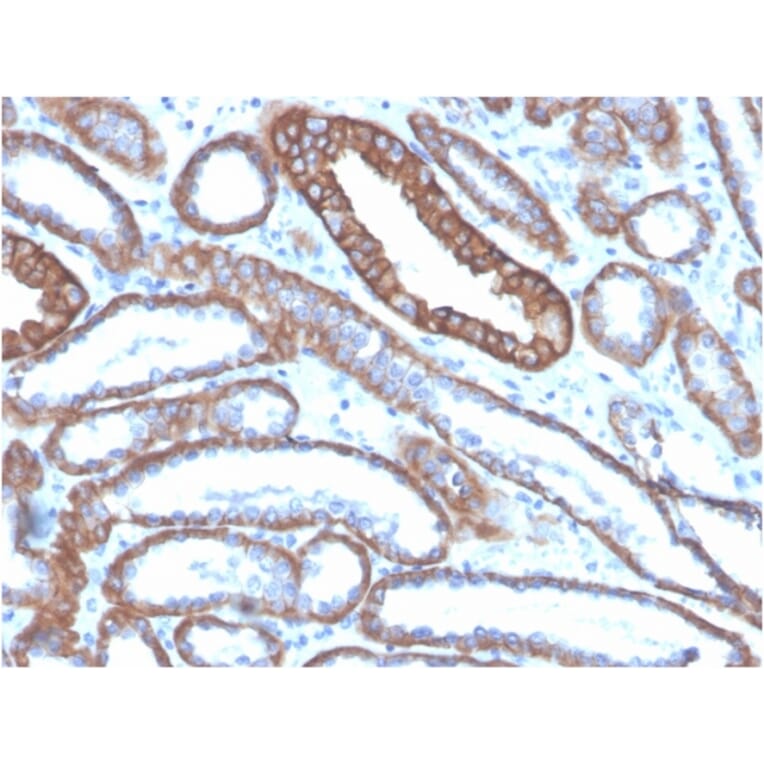 Immunohistochemistry - Anti-E Cadherin Antibody [CDH1/4585] - BSA and Azide free (A254003) - Antibodies.com