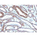 Immunohistochemistry - Anti-E Cadherin Antibody [CDH1/4585] - BSA and Azide free (A254003) - Antibodies.com