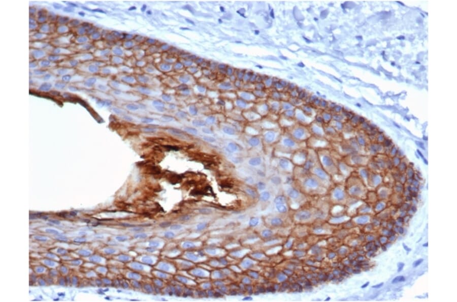 Immunohistochemistry - Anti-E Cadherin Antibody [CDH1/4585] - BSA and Azide free (A254003) - Antibodies.com