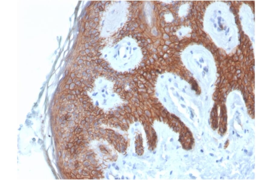 Immunohistochemistry - Anti-E Cadherin Antibody [CDH1/4585] - BSA and Azide free (A254003) - Antibodies.com