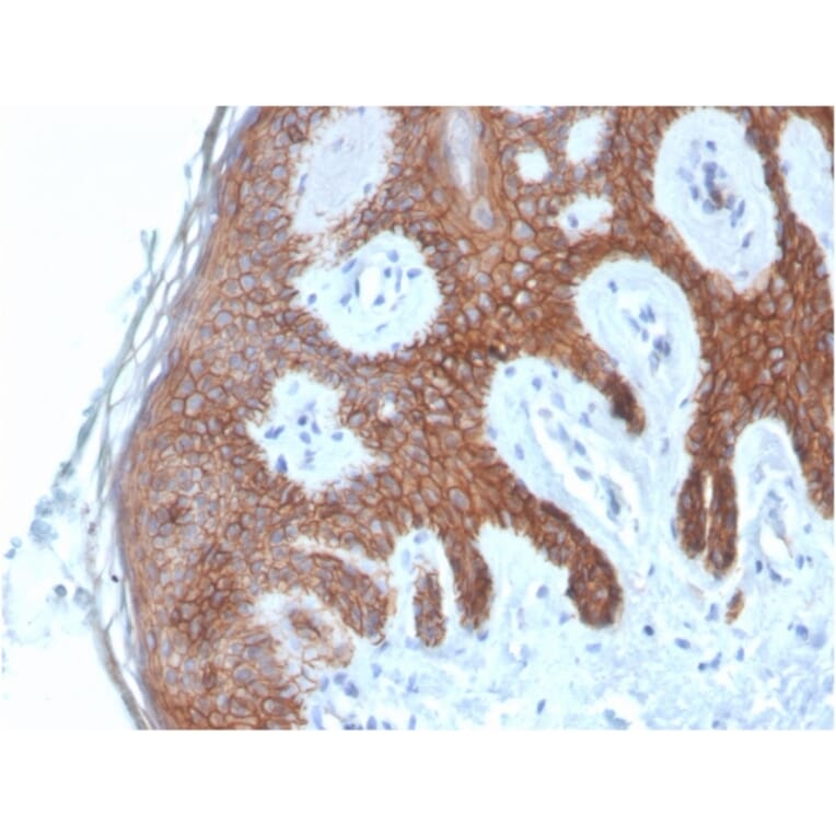 Immunohistochemistry - Anti-E Cadherin Antibody [CDH1/4585] - BSA and Azide free (A254003) - Antibodies.com