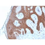 Immunohistochemistry - Anti-E Cadherin Antibody [CDH1/4585] - BSA and Azide free (A254003) - Antibodies.com