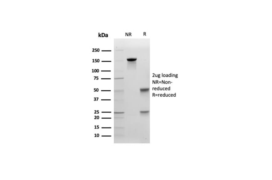 SDS-PAGE - Anti-E Cadherin Antibody [CDH1/4585] - BSA and Azide free (A254003) - Antibodies.com