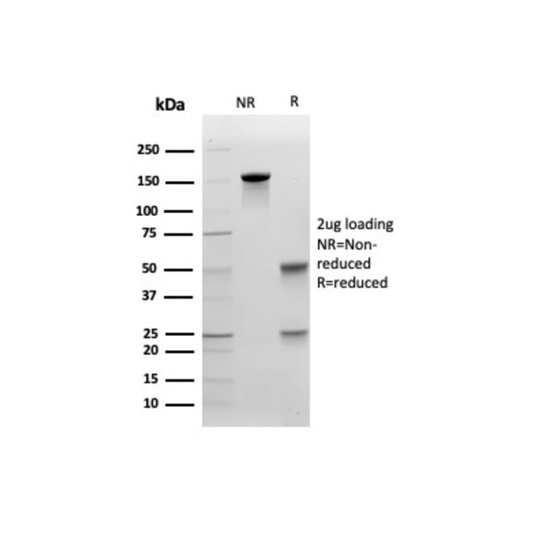 SDS-PAGE - Anti-E Cadherin Antibody [CDH1/4585] - BSA and Azide free (A254003) - Antibodies.com