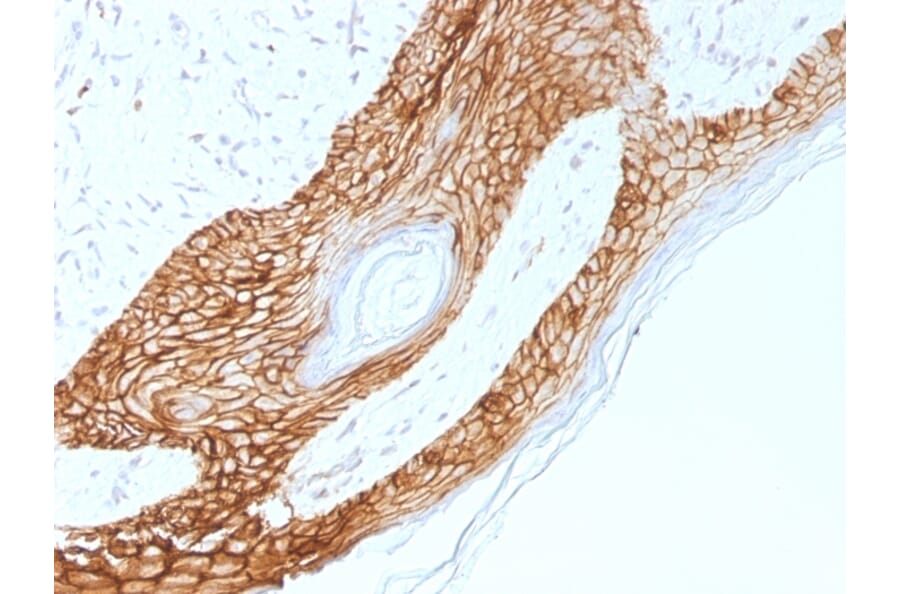 Immunohistochemistry - Anti-E Cadherin Antibody [4A2] - BSA and Azide free (A254004) - Antibodies.com