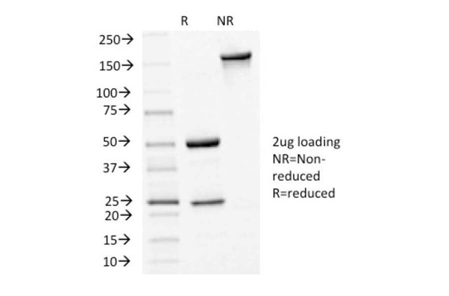 SDS-PAGE - Anti-E Cadherin Antibody [4A2] - BSA and Azide free (A254004) - Antibodies.com