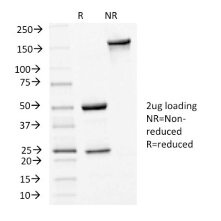 SDS-PAGE - Anti-E Cadherin Antibody [4A2] - BSA and Azide free (A254004) - Antibodies.com