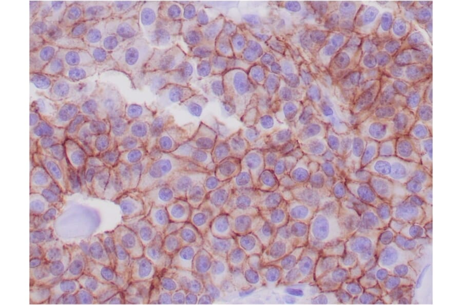 Immunohistochemistry - Anti-E Cadherin Antibody [CDH1/1525] - BSA and Azide free (A254005) - Antibodies.com