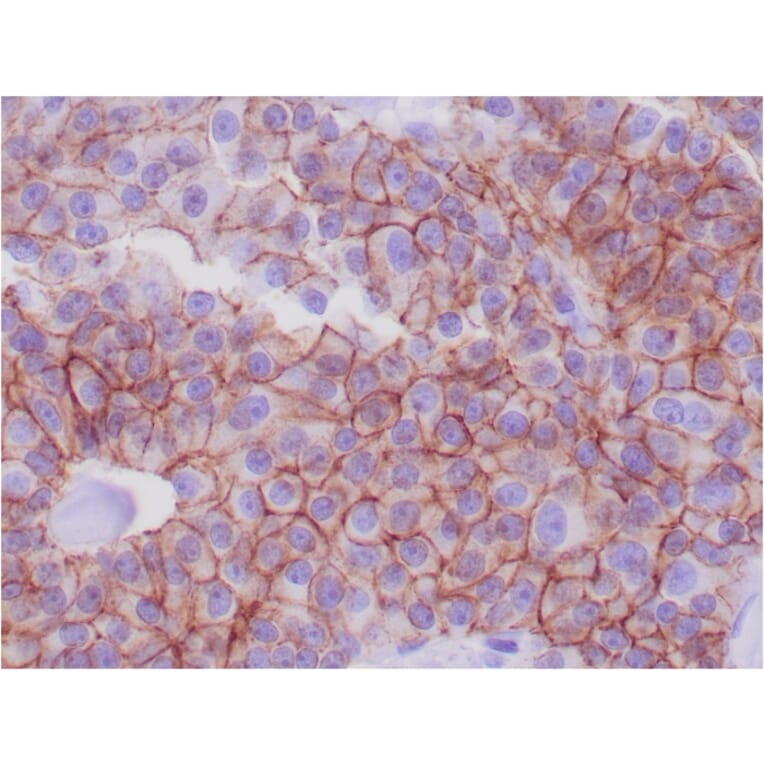 Immunohistochemistry - Anti-E Cadherin Antibody [CDH1/1525] - BSA and Azide free (A254005) - Antibodies.com