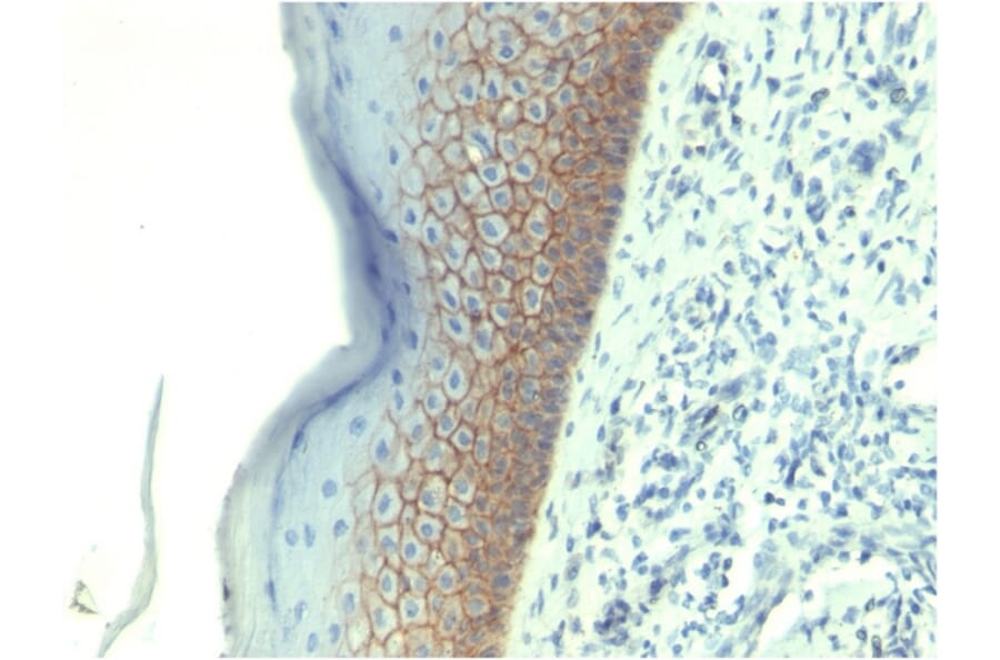 Immunohistochemistry - Anti-E Cadherin Antibody [CDH1/1525] - BSA and Azide free (A254005) - Antibodies.com