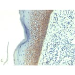 Immunohistochemistry - Anti-E Cadherin Antibody [CDH1/1525] - BSA and Azide free (A254005) - Antibodies.com