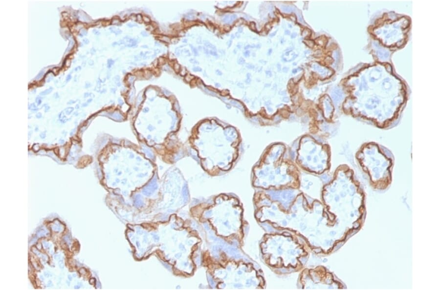 Immunohistochemistry - Anti-E Cadherin Antibody [CDH1/1525] - BSA and Azide free (A254005) - Antibodies.com