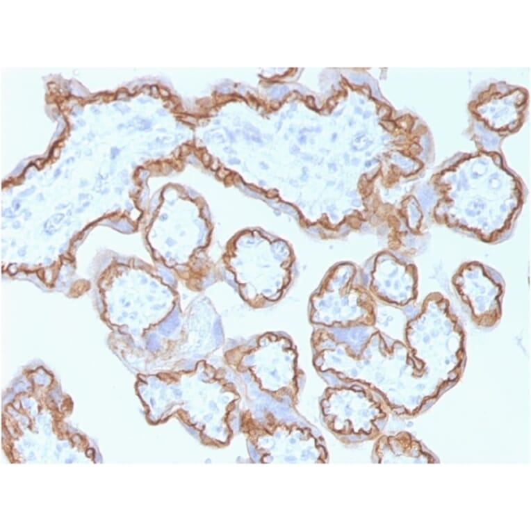 Immunohistochemistry - Anti-E Cadherin Antibody [CDH1/1525] - BSA and Azide free (A254005) - Antibodies.com