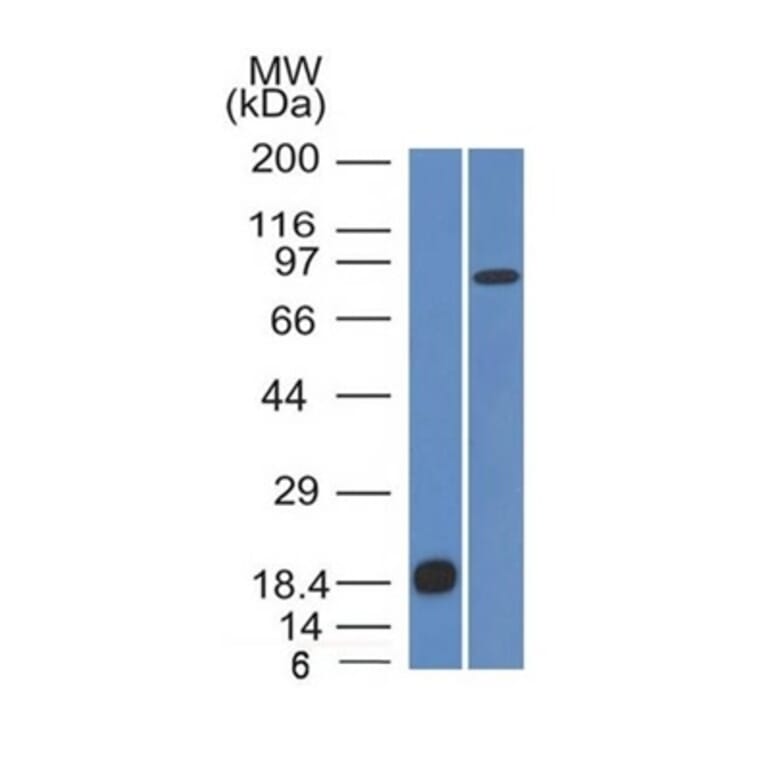 Western Blot - Anti-E Cadherin Antibody [CDH1/1525] - BSA and Azide free (A254005) - Antibodies.com