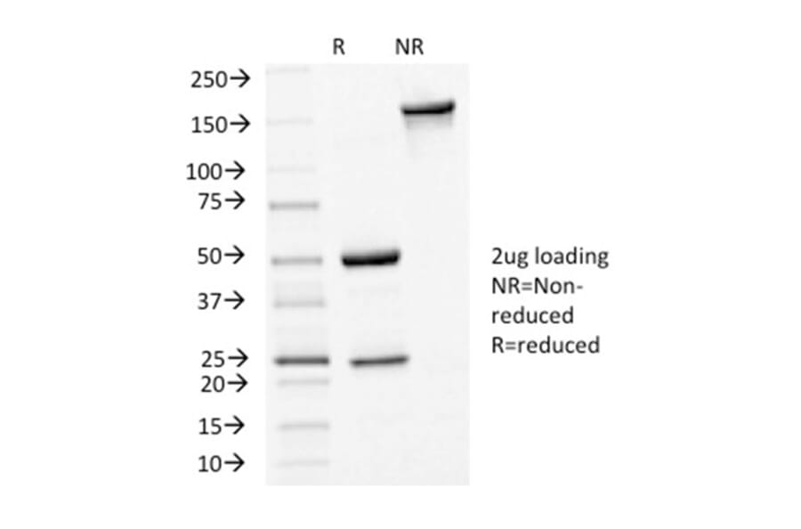 SDS-PAGE - Anti-E Cadherin Antibody [CDH1/1525] - BSA and Azide free (A254005) - Antibodies.com