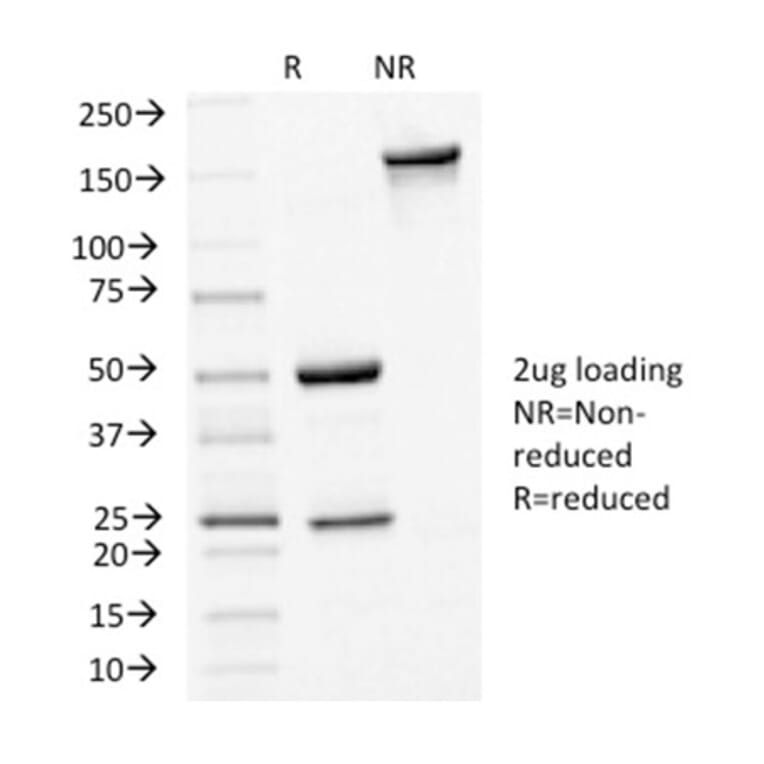 SDS-PAGE - Anti-E Cadherin Antibody [CDH1/1525] - BSA and Azide free (A254005) - Antibodies.com