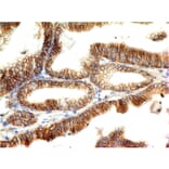Immunohistochemistry - Anti-E Cadherin Antibody [CDH1/1525] - BSA and Azide free (A254005) - Antibodies.com