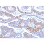 Immunohistochemistry - Anti-E Cadherin Antibody [SPM381] - BSA and Azide free (A254006) - Antibodies.com