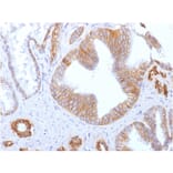Immunohistochemistry - Anti-E Cadherin Antibody [SPM471] - BSA and Azide free (A254007) - Antibodies.com